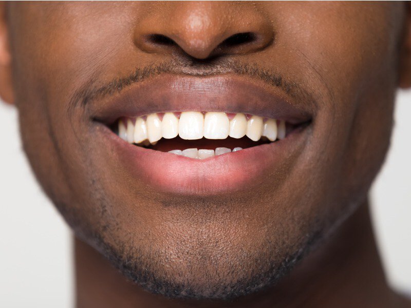 Man with beautiful white teeth