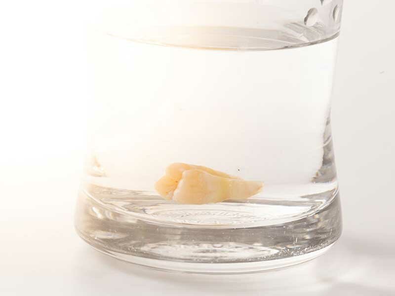 Tooth in glass of water