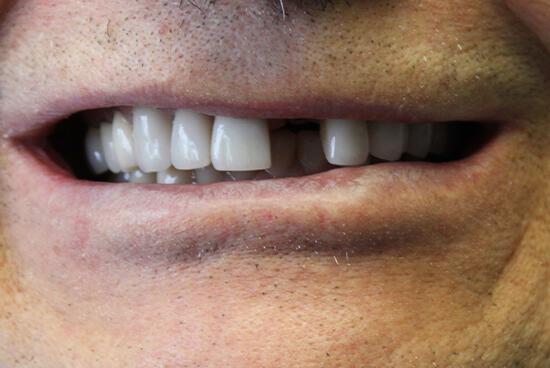 dental procedure before image