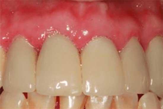dental procedure after image